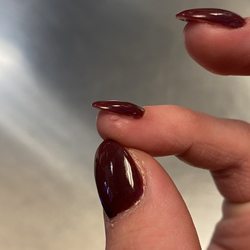 Nailganic - Cut my pinky finger, didn't clean file after