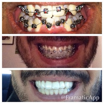 Holistic Orthodontics - From start to finish. Don't forget to wear your retainer! - Orthodontists Near Me - Northridge, California Holistic Orthodontics - From start to finish. Don't forget to wear your retainer! - Orthodontists Near Me - Northridge, California