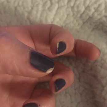 Nails By Porter - Chipped gel after 5 days - Skin Care Near Me - Cambridge, Massachusetts Nails By Porter - Chipped gel after 5 days - Skin Care Near Me - Cambridge, Massachusetts