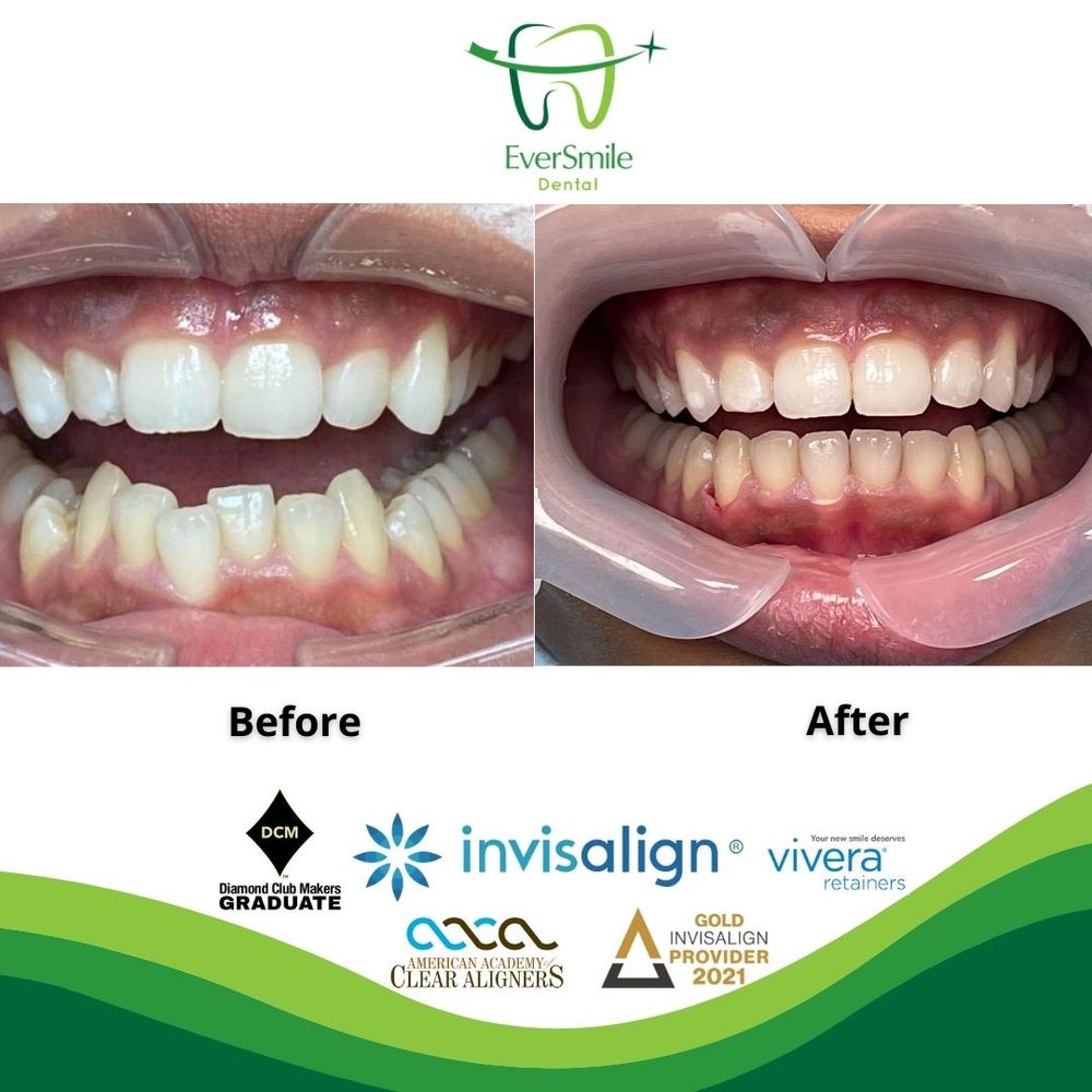 EVERSMILE DENTAL 19 Photos & 18 Reviews 479 N Midland Ave, Saddle