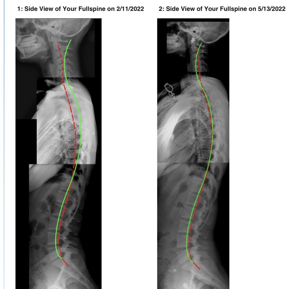 CorePosture Chiropractic - X-ray - Chiropractors Near Me - Newport Beach, California CorePosture Chiropractic - X-ray - Chiropractors Near Me - Newport Beach, California