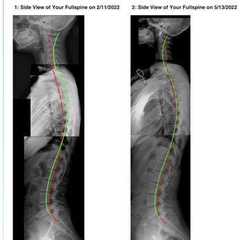 CorePosture Chiropractic - X-ray - Chiropractors Near Me - Newport Beach, California