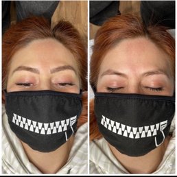 After/before After/before