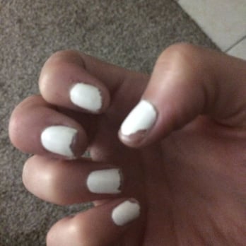 Castle Nail Spa - After one day:( - Nail Salons Near Me - Normal, Illinois