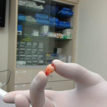 Karen Arakelian DDS - Removed Wisdom teeth - General Dentistry Near Me - Sherman Oaks, California Karen Arakelian DDS - Removed Wisdom teeth - General Dentistry Near Me - Sherman Oaks, California