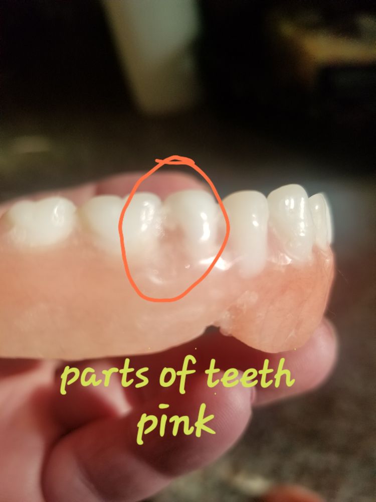 YUBA CITY AFFORDABLE DENTURES 25 Photos & 41 Reviews 1054 Harter Rd