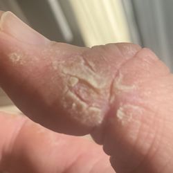 Premier Dermatology - Left
