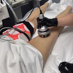 Simple Skincare Laser & Spa