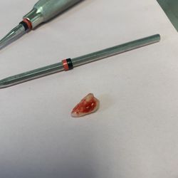 Southern Dental Care - Wisdom tooth