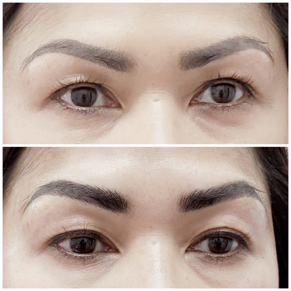 Before and After