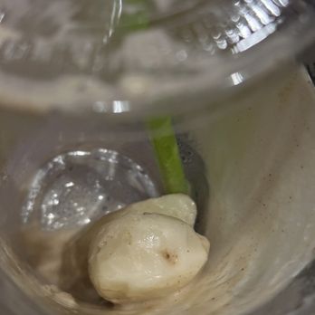 Pure Green - massive chunks of unblended frozen bananas in my sad smoothie - Juice Bars & Smoothies Near Me - Chicago, Illinois Pure Green - massive chunks of unblended frozen bananas in my sad smoothie - Juice Bars & Smoothies Near Me - Chicago, Illinois