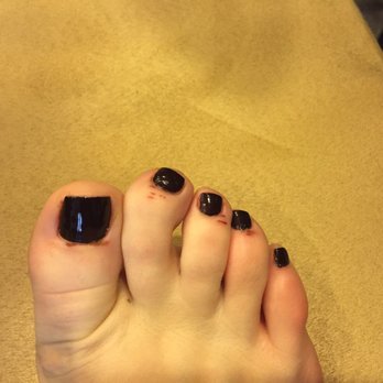 Lotus Nails - You can see where Linda scratched my toes. It hurt a lot for a few days, I was scared the cuts were infected. Luckily everything was fine. - Nail Salons Near Me - Gaithersburg, Maryland