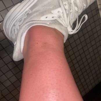 7 Wonders - 1 hour after pedi (tiny blisters were forming and oozing) - Nail Salons Near Me - Spokane, Washington