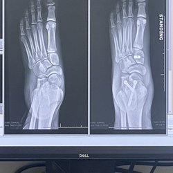 Ortho Carolina - Before and after