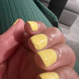 Clipped polish-attempted to file the gel to prevent farther damage but the polish is too thick. Clipped polish-attempted to file the gel to prevent farther damage but the polish is too thick.