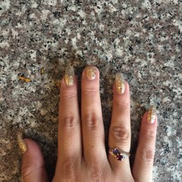 My broken nail