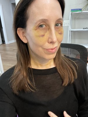 Austin-Weston, The Center For Cosmetic Surgery by null