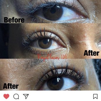 Royal Faces Skin Care - Skin Care Near Me - Bellflower, California
