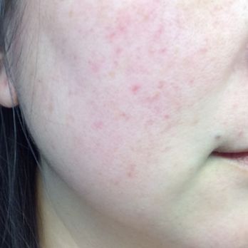 Scott Michael J DO III - December 2018 - Dermatologists Near Me Scott Michael J DO III - December 2018 - Dermatologists Near Me