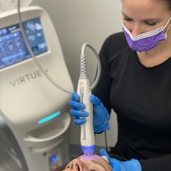 Nativis Aesthetics - RF Microneedling treatments helps tighten the skin, decrease pore size, minimize acne scarring, and give your skin a rejuvenated look.