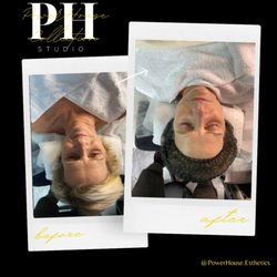 PowerHouse Esthetics - Signature Customized Facial. Ready for healthier skin. Book your appointment today