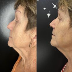 Skin Rejuvenation Station