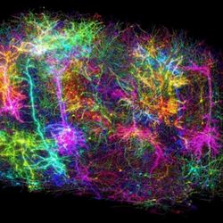 Dignity Health Medical Group - Brain circuits mapped.