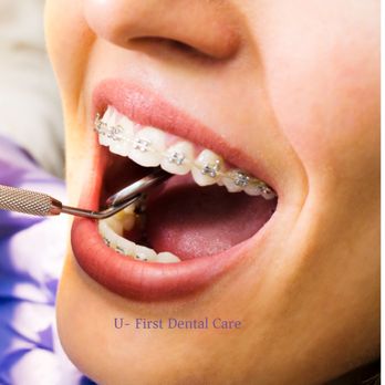 U-First Dental Care - General Dentistry Near Me - Rancho Cucamonga, California U-First Dental Care - General Dentistry Near Me - Rancho Cucamonga, California