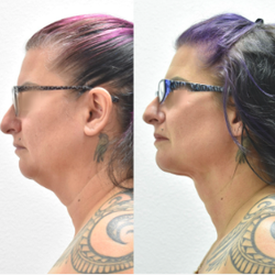 BelleSculpt