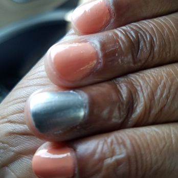 French Nails - 2 days after manicure, scarred cuticles - Nail Salons Near Me - Libertyville, Illinois French Nails - 2 days after manicure, scarred cuticles - Nail Salons Near Me - Libertyville, Illinois