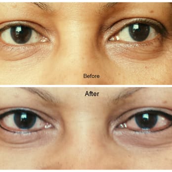 My Permanent Make Up - EYELINER before & after - Makeup Artists Near Me - Fair Lawn, New Jersey My Permanent Make Up - EYELINER before & after - Makeup Artists Near Me - Fair Lawn, New Jersey