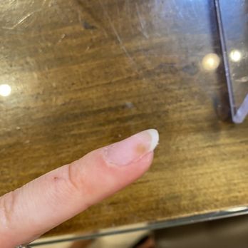 Casa Beauty - Fungus - Nail Salons Near Me - Aventura, Florida