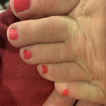 Top City Nails - Paint job, red swollen area on toe - Nail Salons Near Me - Riverside, California Top City Nails - Paint job, red swollen area on toe - Nail Salons Near Me - Riverside, California