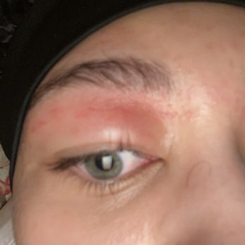 Organic Nails and Spa 3 - my eyelid two days after the wax and several rounds of applying ice - Nail Salons Near Me - Fairfax, Virginia