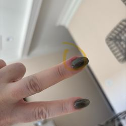 D Luxe Nail Bar - Infected cuticle because they cut my finger with dirty tools