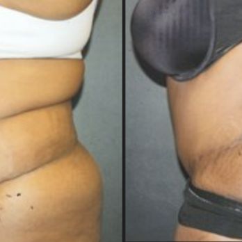 1. Center For Cosmetic & Reconstructive Surgery
