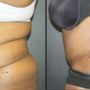 Photo of Center For Cosmetic & Reconstructive Surgery