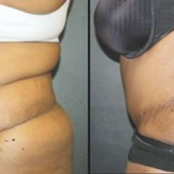 Center For Cosmetic & Reconstructive Surgery