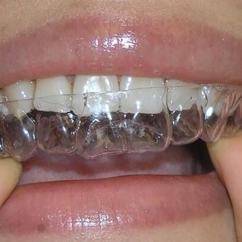 Pay Less 4 Braces - Connecticut - Orthodontists Near Me - Norwalk, Connecticut Pay Less 4 Braces - Connecticut - Orthodontists Near Me - Norwalk, Connecticut