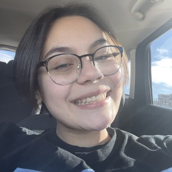 Chenin Orthodontic Group - Summerlin - Perfectly straight teeth after almost 2 years! - Orthodontists Near Me - Las Vegas, Nevada Chenin Orthodontic Group - Summerlin - Perfectly straight teeth after almost 2 years! - Orthodontists Near Me - Las Vegas, Nevada