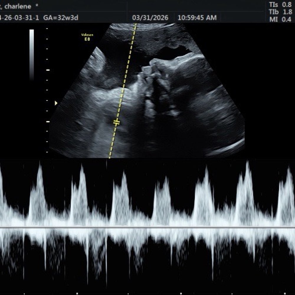 Baby’s First Glance - Ultrasound Imaging Centers Near Me - San Jose, California Baby’s First Glance - Ultrasound Imaging Centers Near Me - San Jose, California