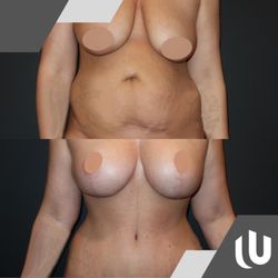 Phuong M Pham, MD - United Plastic Surgery - United Plastic Surgery | Mommy Makeover