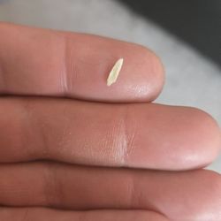 McDonald's - Bone or plastic in chicken nuggets