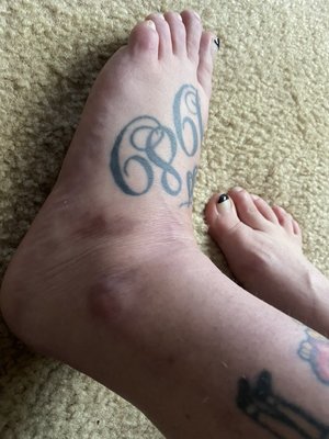 Hughston Clinic  - Dothan