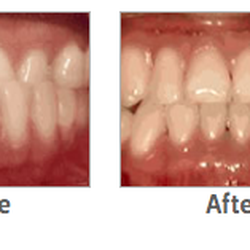 Arctic Smiles Orthodontics
