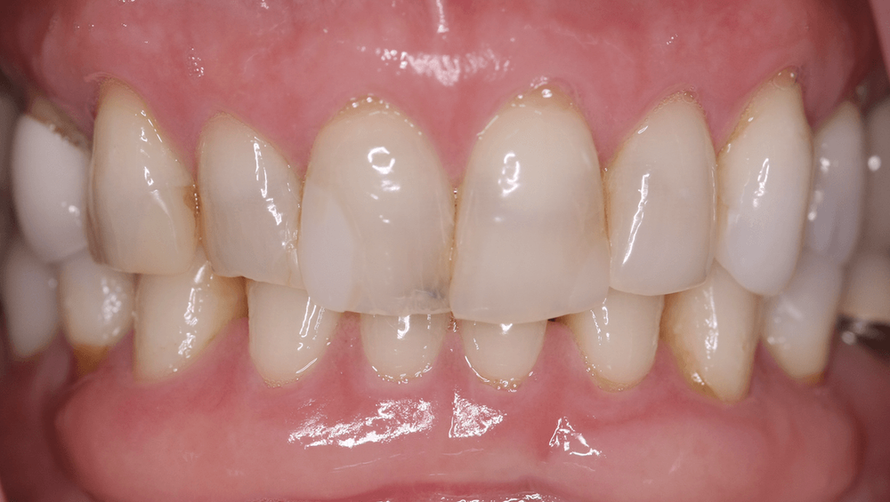 SmileCare Dental