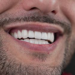 Smile Design Miami