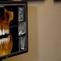 Atlanta Endodontics