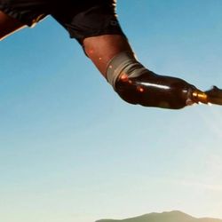 Star Mobility Prosthetics