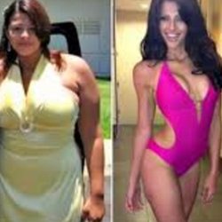 Medical Weight Loss